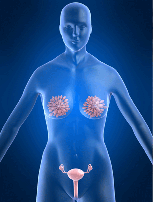 제일산부인과 부인암유방암